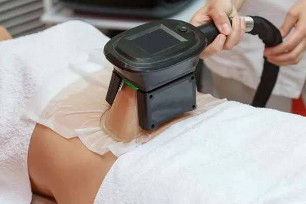 Image of person having fat freezing treatment to help weight gain Cambridge