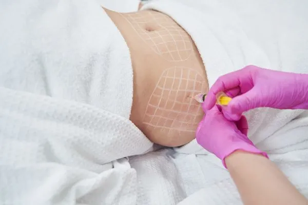 image of fat dissolving injections on love handles to help combat weight gain Cambridge