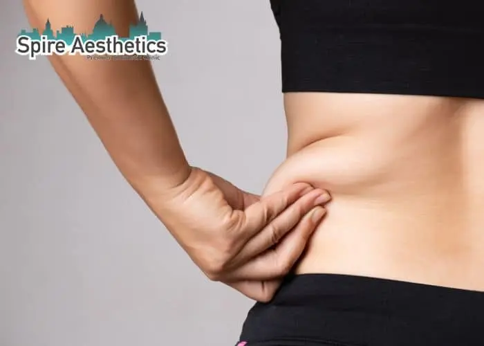 Image of woman pinching fat on their hips Cambridge. Fat Freezing treatment
