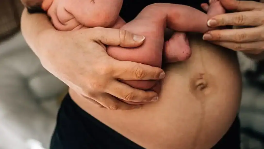 Why Is My Stomach Still Big After Pregnancy Cambridge?